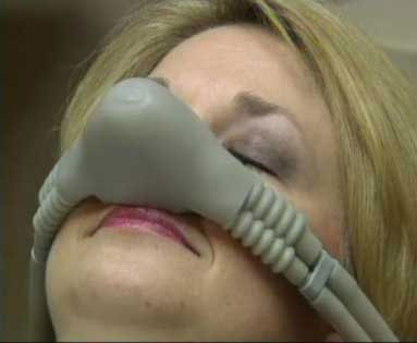 A woman inhales nitrous oxide through a mask placed over her nose. Nitrous oxide is one tool we offer as part of our sedation dentistry.