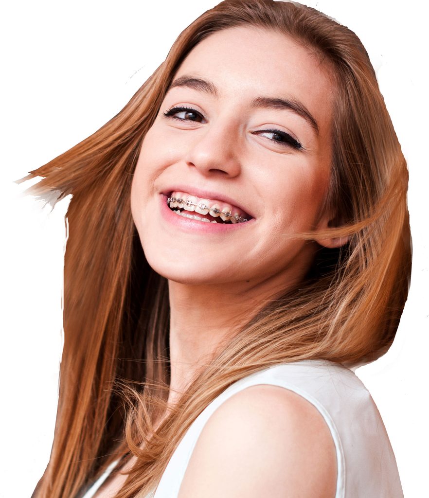 A young woman smiles with braces. Braces are one treatment an orthodontist may recommend for smile alignment.